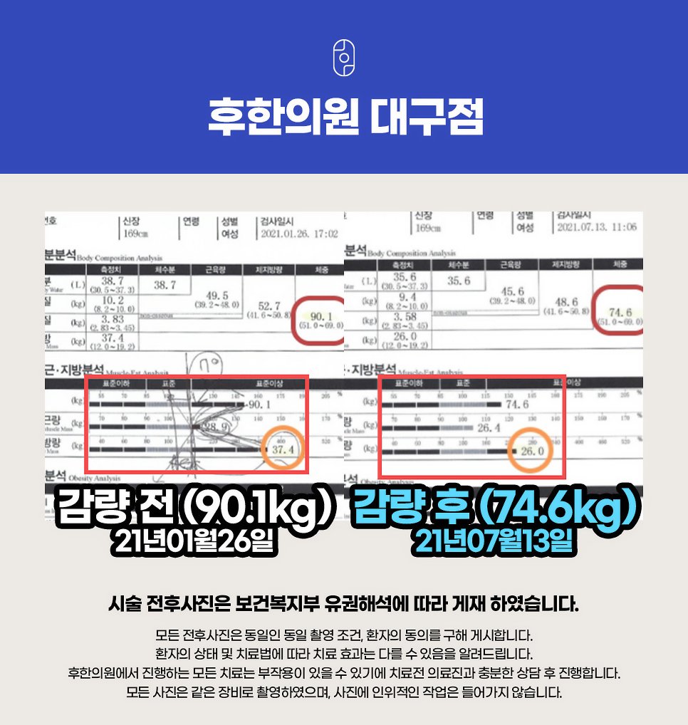 대구 후한의원 다이어트 전후 인바디