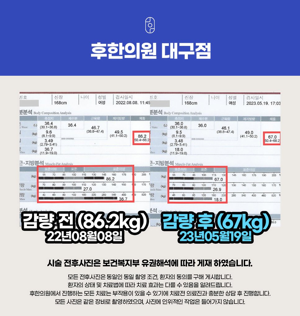 대구 후한의원 다이어트 전후사진