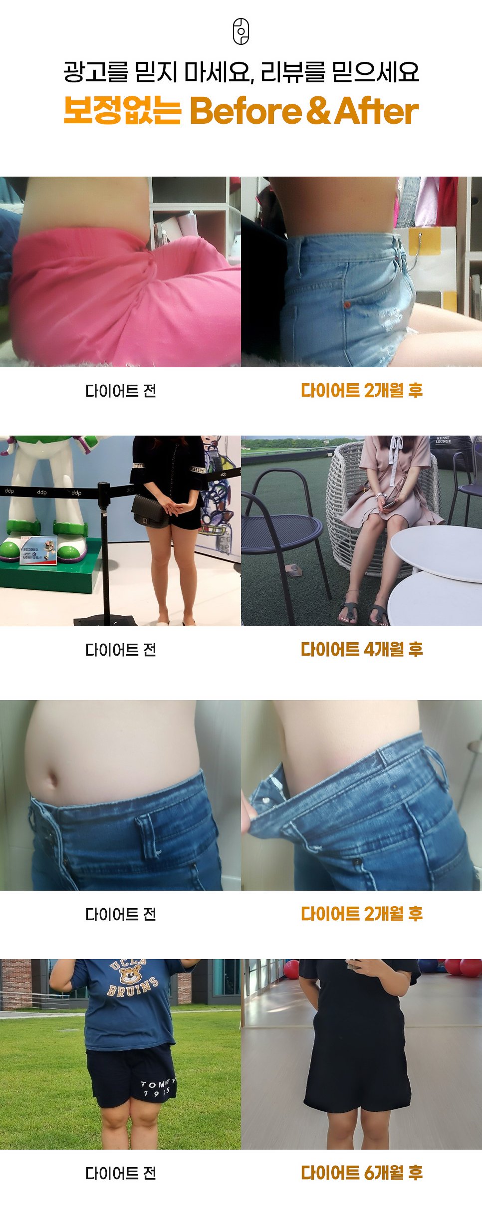 대구 비만약 다이어트 전후 