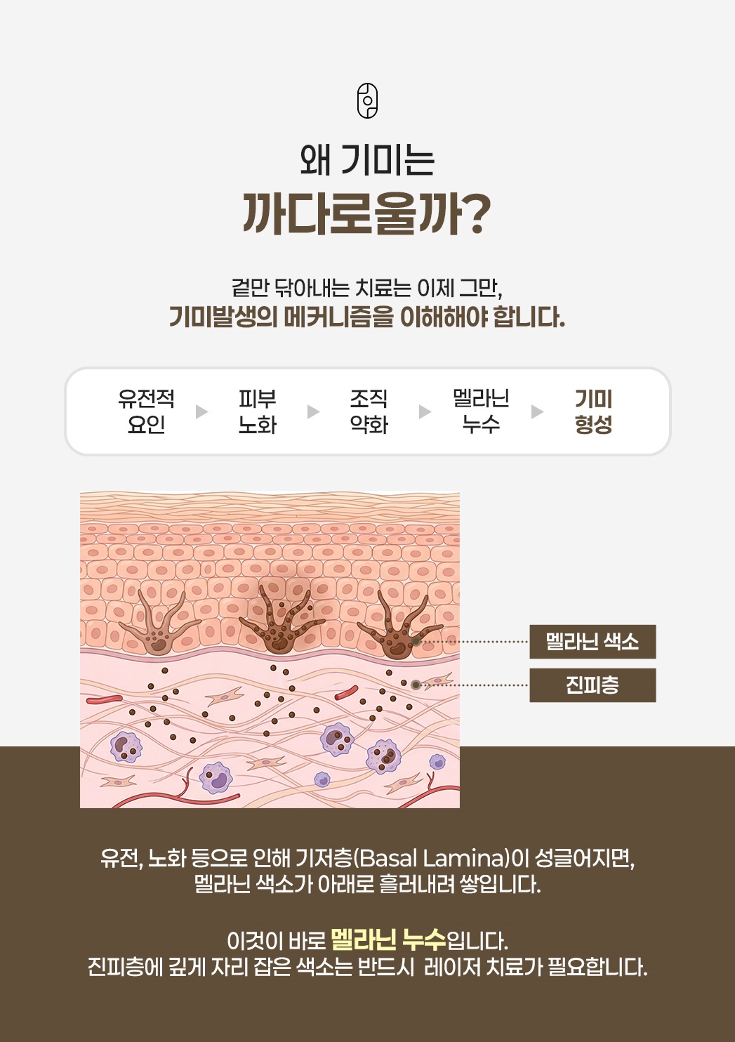 기미가 까다로운 이유, 유전부터 멜라닌 누수까지 발생 과정