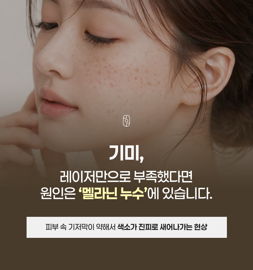 대구기미잡티레이저, 레이저만으로 부족한 이유는 멜라닌 누수