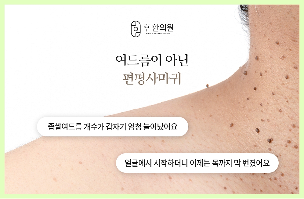편평사마귀의 정의를 설명하는 내용의 이미지