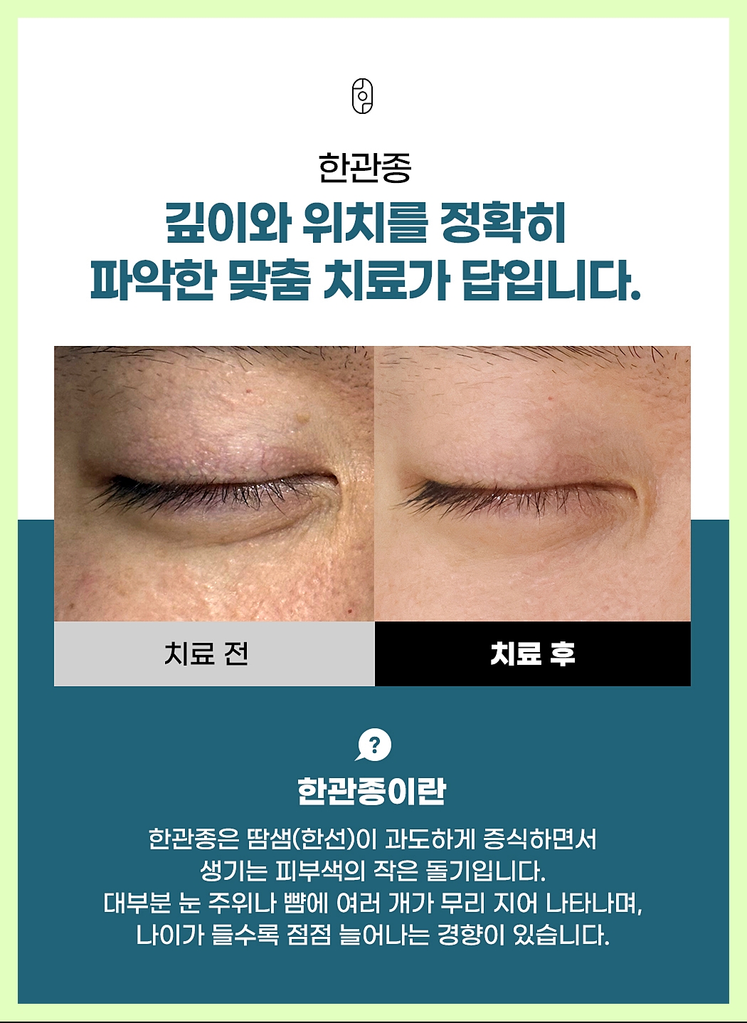 대구잡티제거 한관종의 다양한 내용을 정리한 이미지