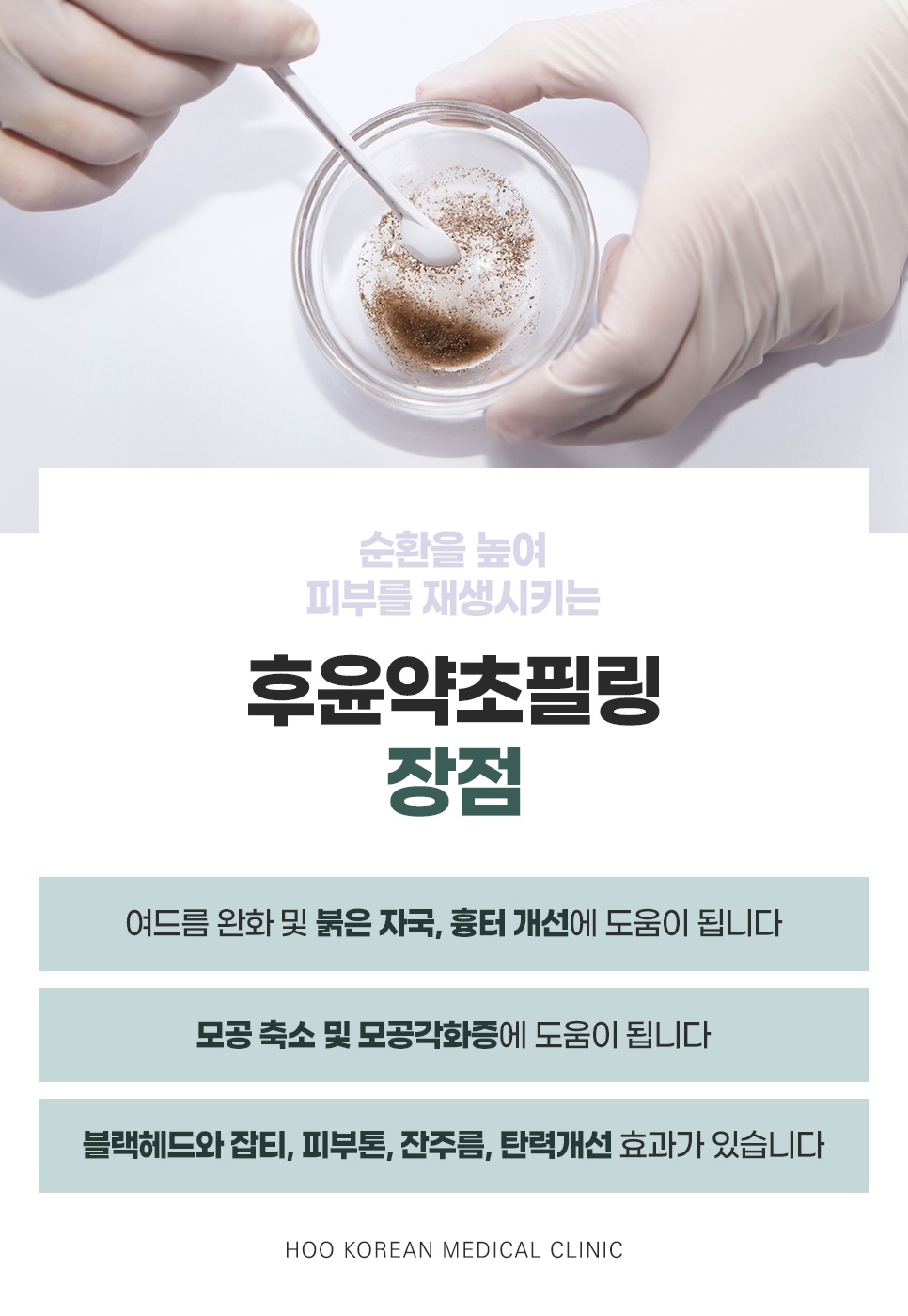 후윤약초필링 시술 장면과 여드름 완화, 모공 축소 등 효과 안내
