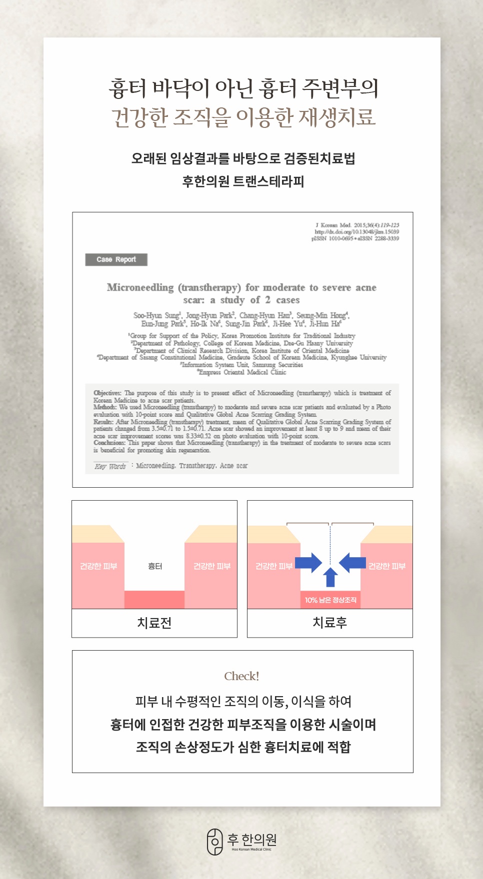 후한의원 트랜스테라피 흉터 주변부 피부 조직 이용 재생치료 원리