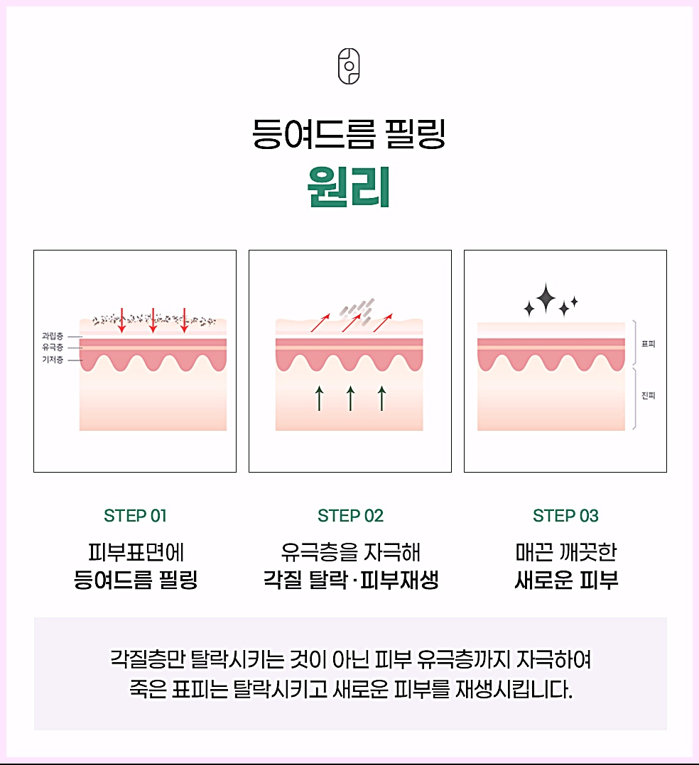 후한의원 대구점에서 진행하는 등여드름 필링 원리 3단계