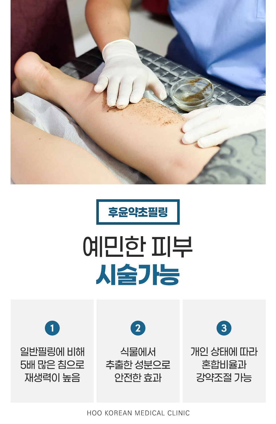 예민한 피부에도 시술 가능한 후윤약초필링의 특징(재생력, 성분, 강약 조절) 설명