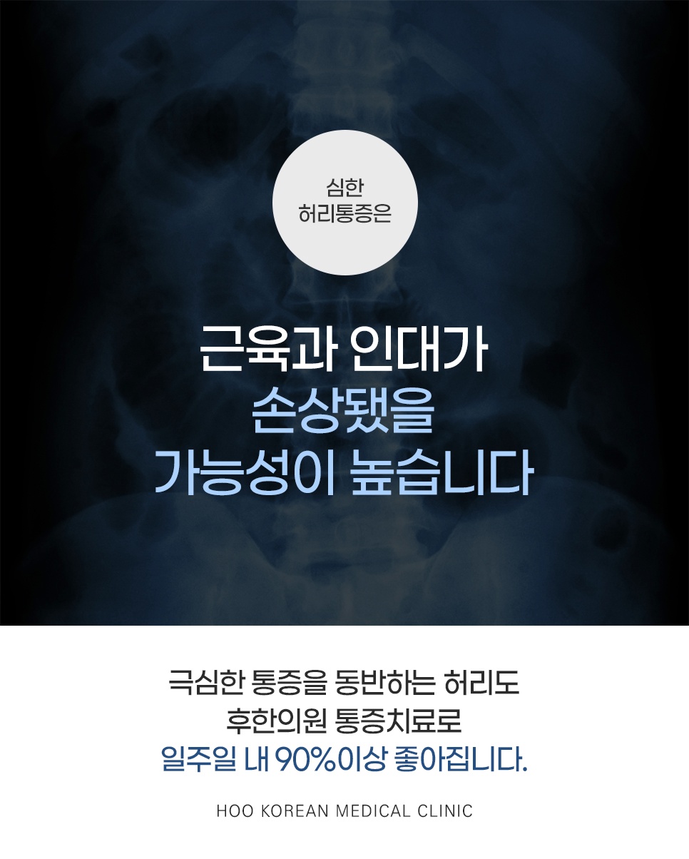 허리 근육 및 인대 손상 진단과 통증 완화 치료