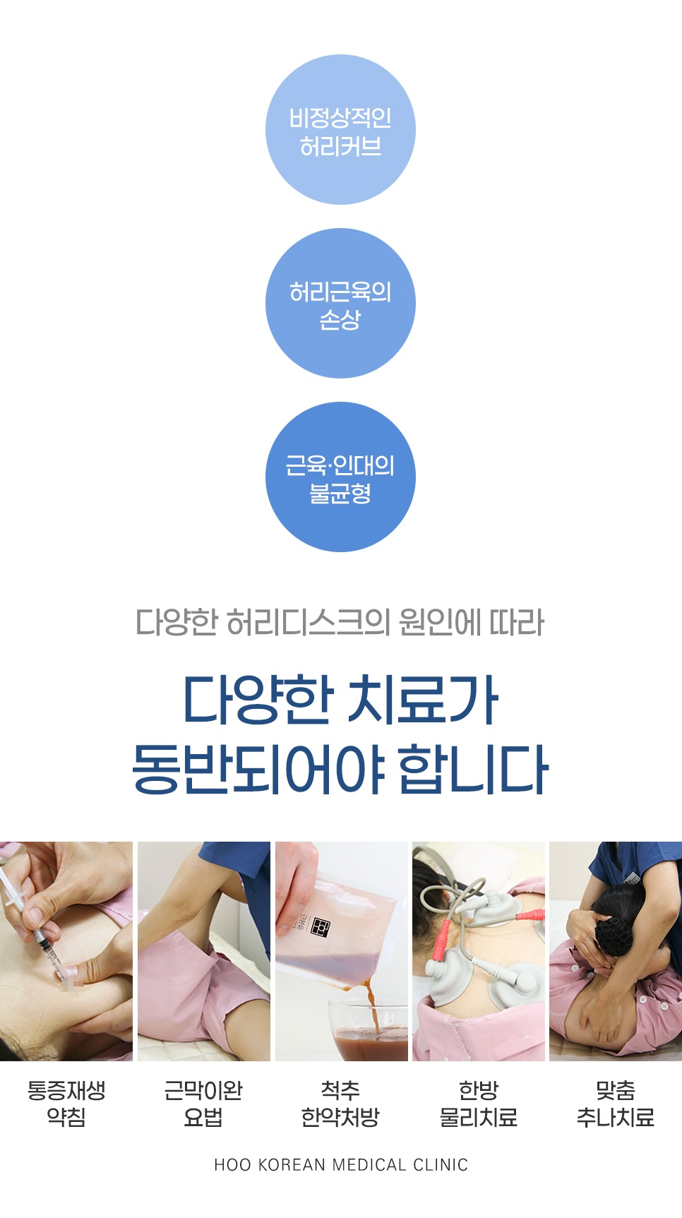 약침 추나 한약 등 개인별 맞춤 허리 치료 솔루션
