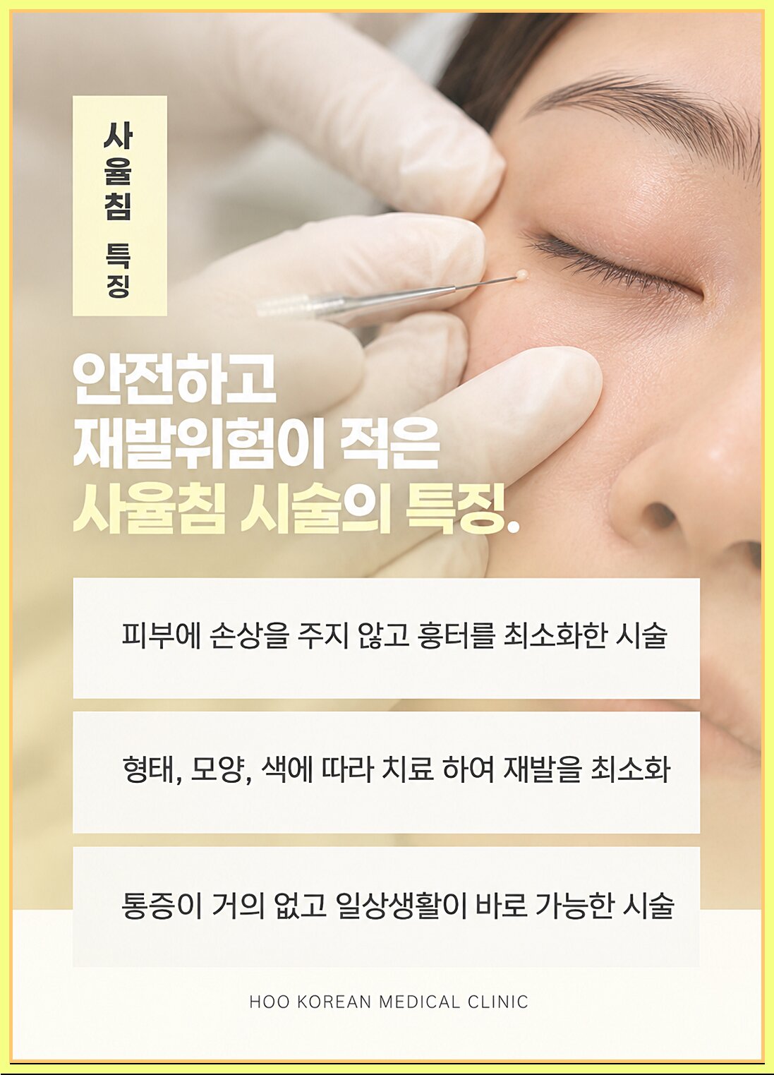 후한의원 사율침 시술 장점