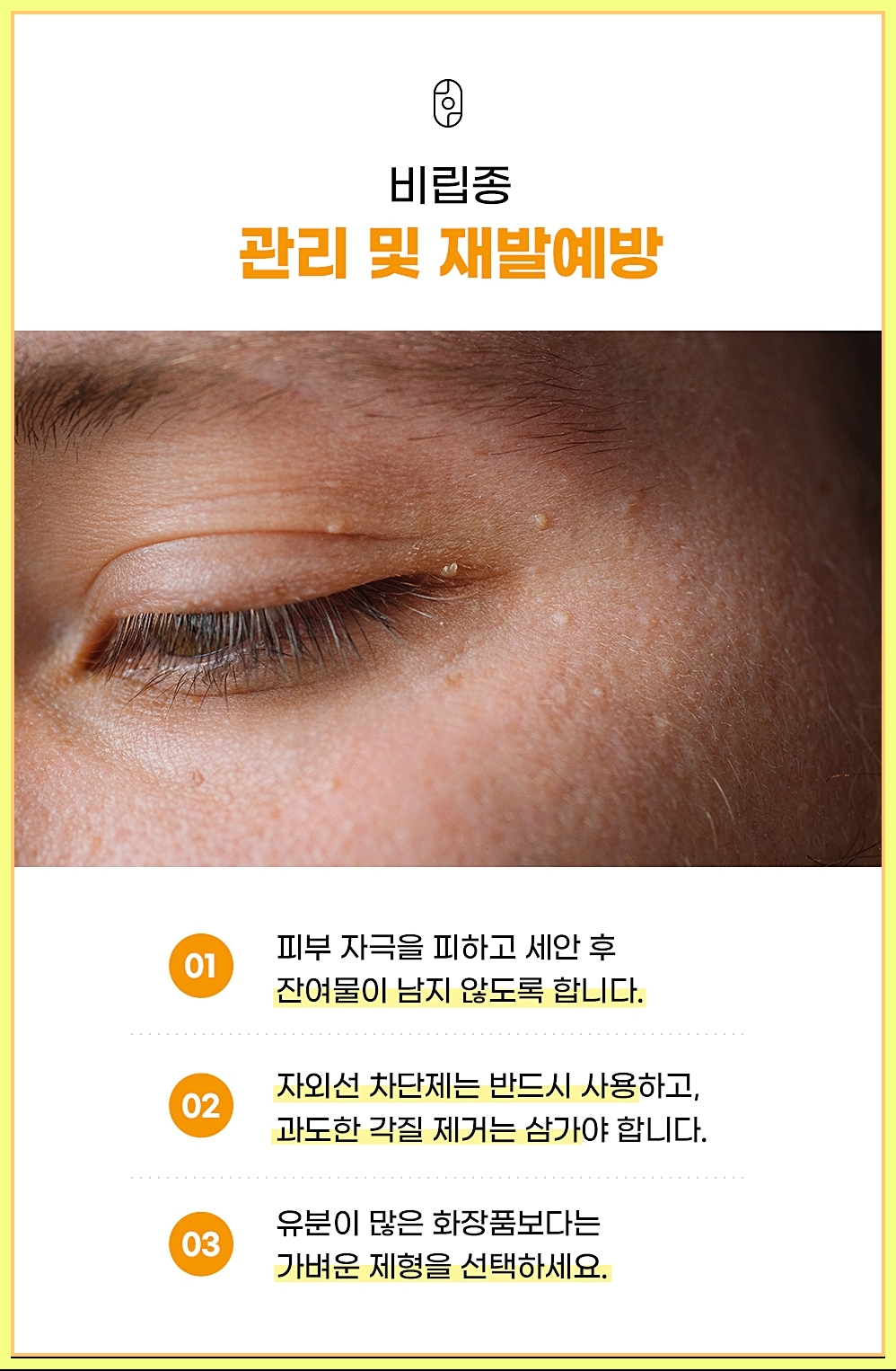 재발 예방을 위한 관리 방법