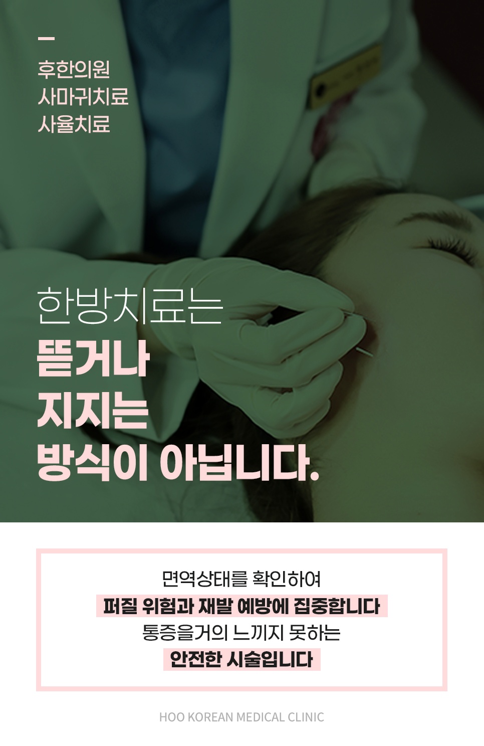 뜯거나 지지지 않고 침으로 접근하는 사마귀 사율치료 시술 장면