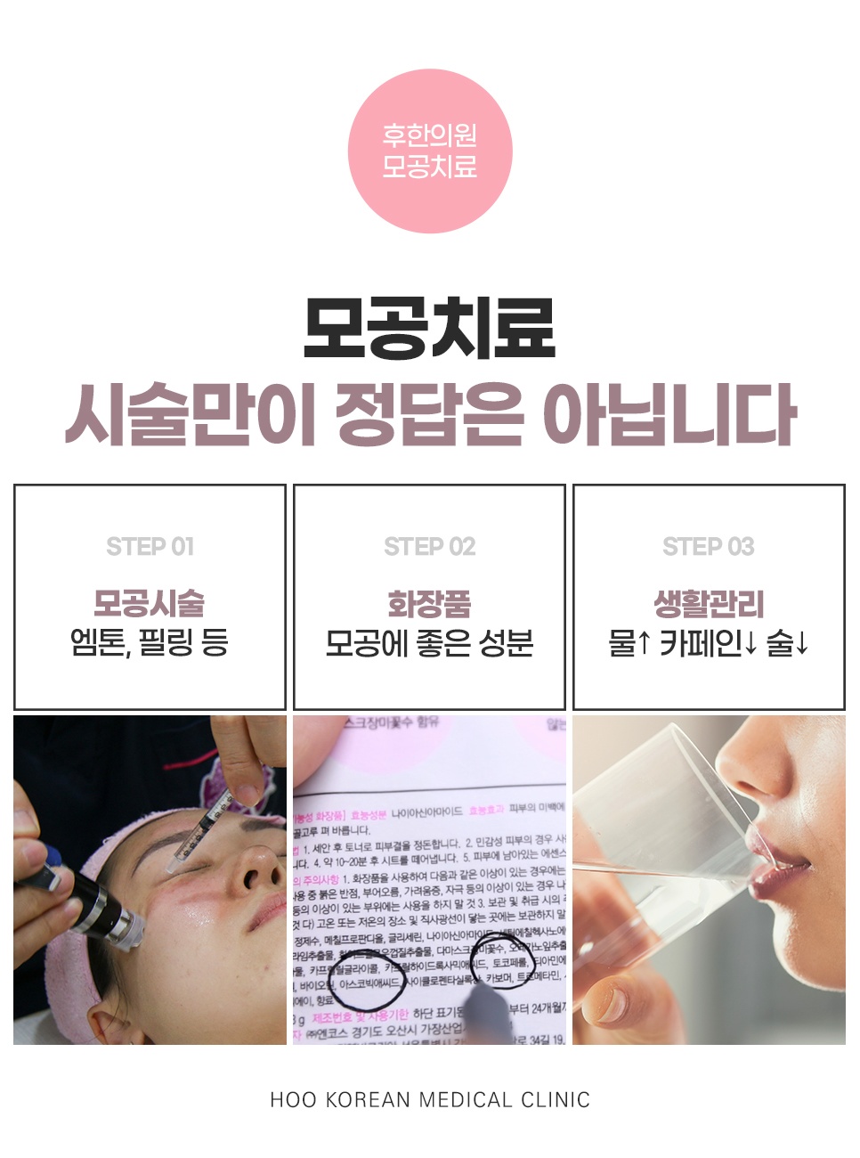 모공시술·화장품·생활관리 3단계로 짚는 모공치료 안내