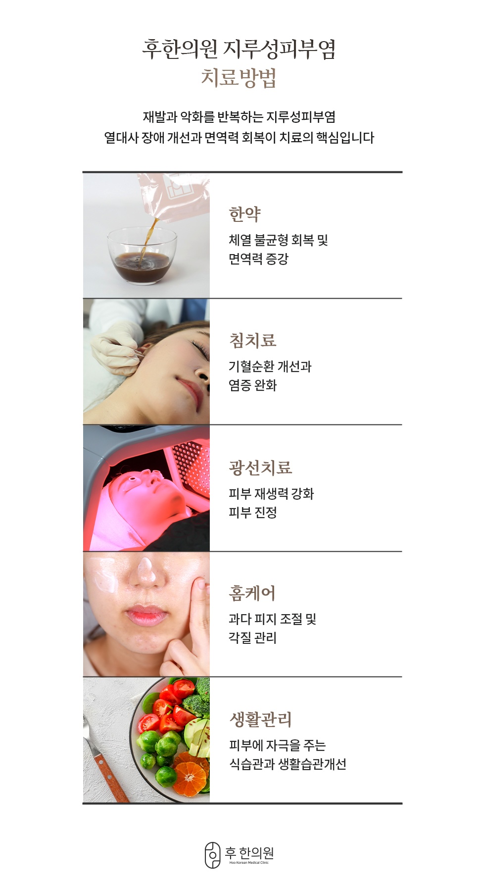 한약·침치료·광선치료·홈케어·생활관리 5가지로 구성한 후한의원 지루성피부염 치료방법