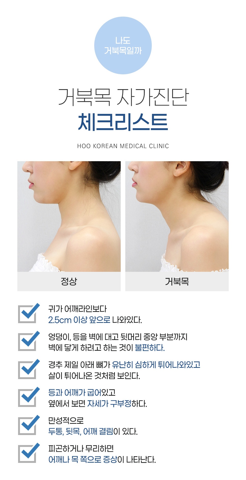 귀가 어깨라인보다 2.5cm 이상 앞으로 나온 정도부터 만성 두통·뒷목·어깨 결림까지 확인하는 거북목 자가진단 체크리스트