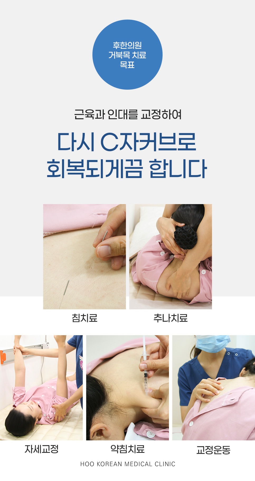 침치료, 추나치료, 자세교정, 약침치료, 교정운동으로 근육과 인대를 교정해 C자 커브를 회복하는 거북목 치료 목표