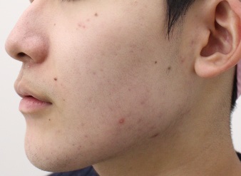 After